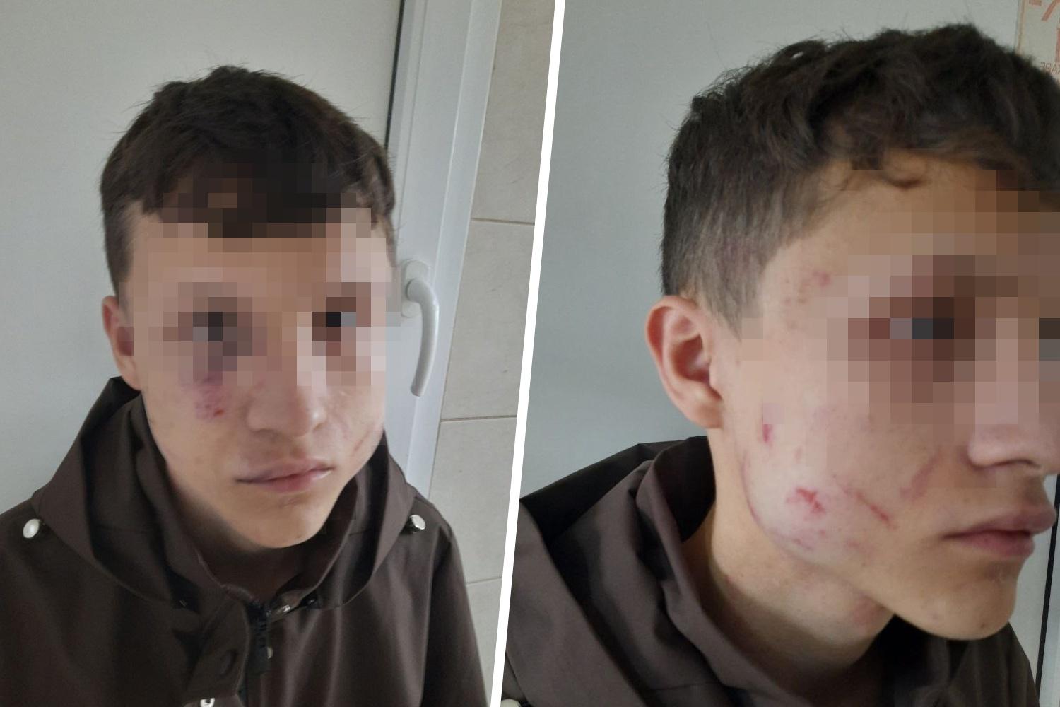 В Тюмени двое неизвестных избили и пытались утопить подростка