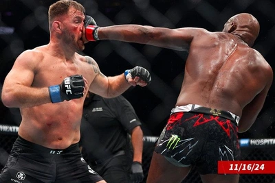 Jon Jones on hip pain and future fights