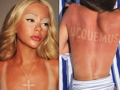 Поцелованные солнцем: почему tan lines нравятся модницам, но ужасают врачей