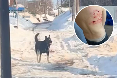 Собака напала на ребенка в Нижегородской области, сорвавшись с цепи