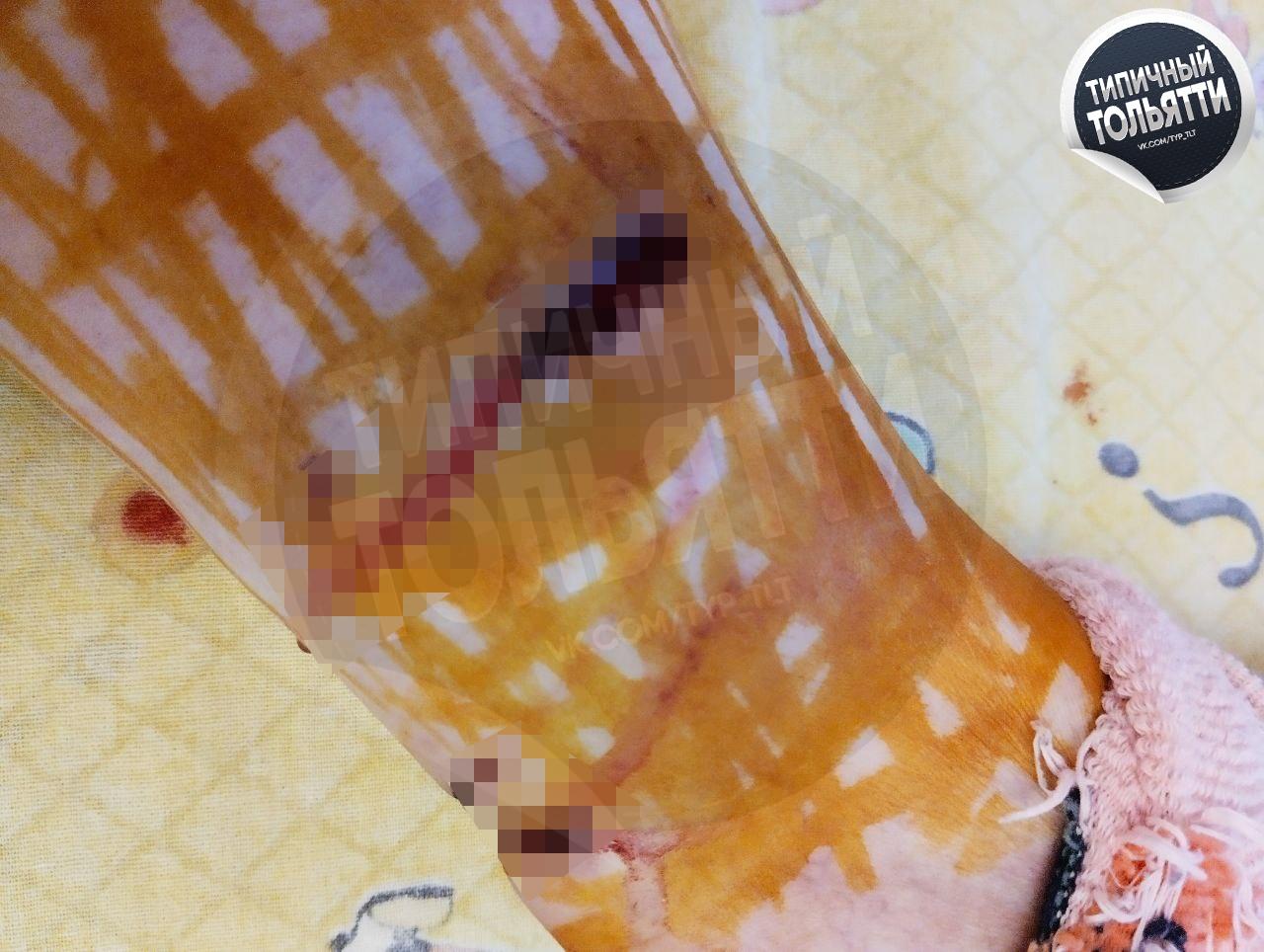 «Выбирают женщин» — стая бродячих собак на Воскресенской прокусила ногу жительнице Тольятти