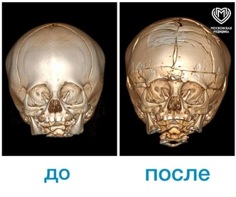 Источник: https://t.me/roshal_clinic/ 