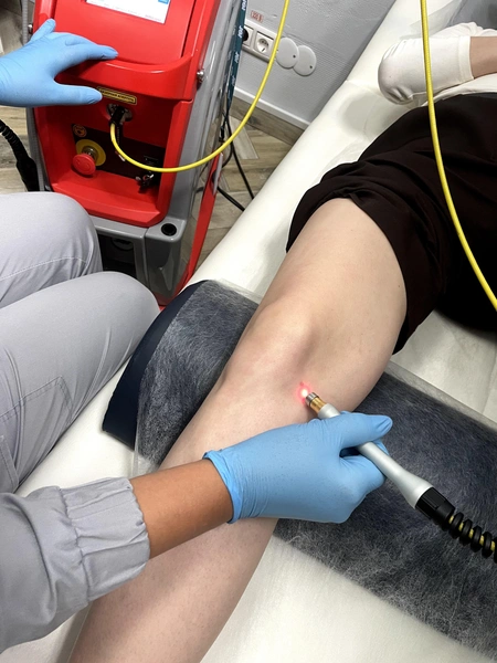 Высокоинтенсивный лазер HIRO 3.0 (HILT терапия) | Источник: «Медицина Сибири»