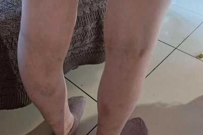 В Тюмени возбудили дело об истязании детей из приюта