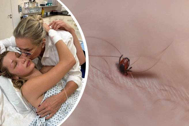 Последнее обострение болезни у супермодели было в августе этого года после лечения у стоматолога | Источник: yolanda.hadid / Instagram (экстремистская организация, деятельность запрещена на территории РФ), Александр Ощепков / NGS.RU