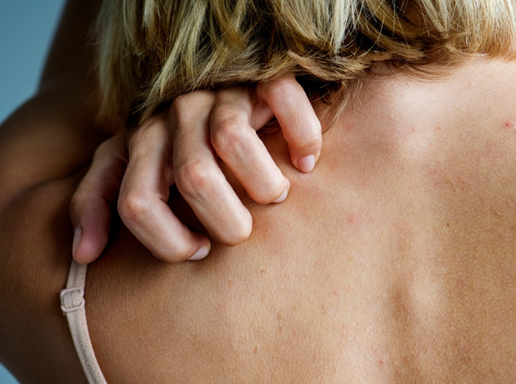 Оксидативный стресс: что это такое, и почему он опасен для вашей кожи