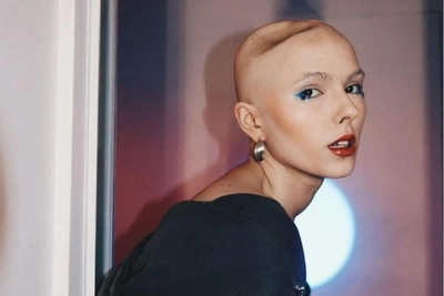 Irina Neboga Loses Cancer Battle at Age 21