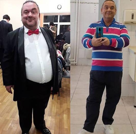 Похудевший на 80 кг Александр Морозов назвал сумму, которую отдал за уменьшение желудка