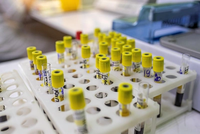 Вирус Нипах: чем опасен, как защититься, носители неизвестны