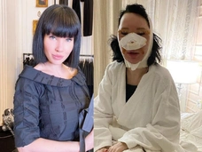 Звезда «Битвы экстрасенсов» Ольга Якубович испугала кадрами после пластических операций