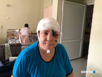 Источник: пострадавший водитель