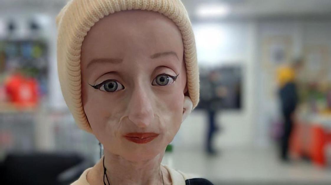 Не будет сдавать ОГЭ и мечтает полететь в Дубай: как живет Аня Добби, начавшая стареть еще в детстве