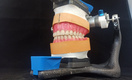 Вместо пластмассы - стекло. Биомеханики придумали, как продлить срок службы зубных протезов