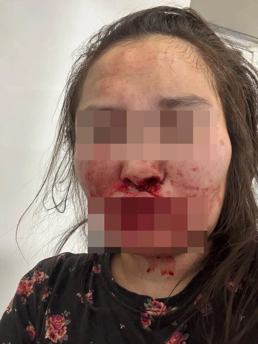 Пострадавшая девушка | Источник: SD Новости Якутии / T.me