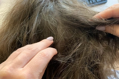 В самарской школе выявили педикулез