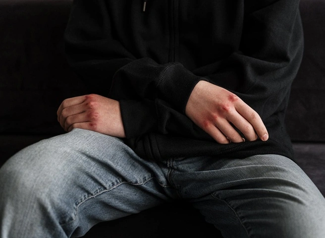 Рязанец, лишивший знакомого глаза, получил условный срок | ya62.ru