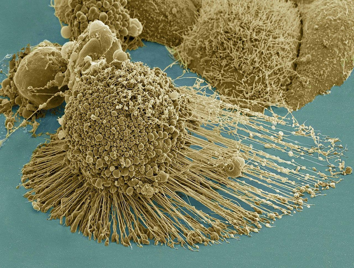 HeLa: как впервые удалось культивировать «бессмертные» клетки человеческого тела