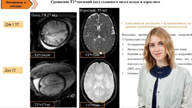 Младший научный сотрудник, врач-рентгенолог «МРТ технологии» МТЦ СО РАН, МЦ «Авиценна» ГК «Мать и Дитя», Новосибирск Алена Горностаева | Источник: «МРТ технологии» МТЦ СО РАН