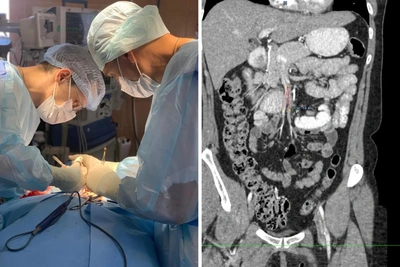 Красноярские хирурги спасли женщину с редким синдромом