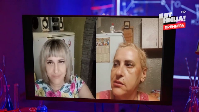 В шоу показали фото женщины до введения филлера и после | Источник: Телеканал «Пятница»