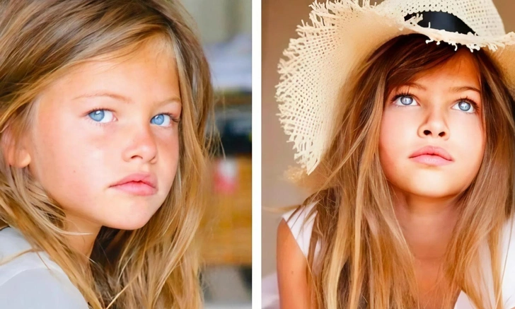 Какой стала самая красивая девочка в мире, которую раньше обожали все: 20 честных фото | Источник: соцсети