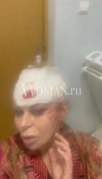 Первые фото Лады Дэнс из больницы: голова разбита, порезы на щеке