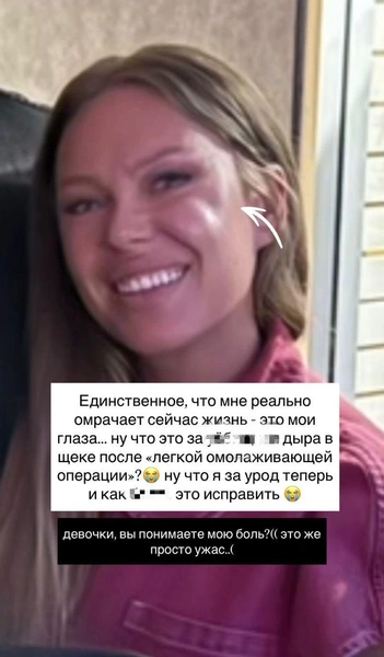Певица страдает от последствий операции