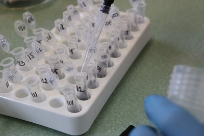 Ученые ЧГМА выиграли грант на изучение загрязнения снега