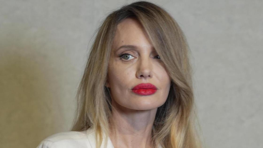 Что не так с новым лицом Джоли? Хирург назвал главную ошибку ее пластики