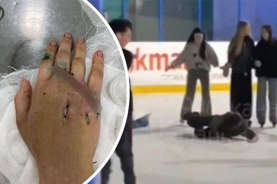 Подросток на катке почти отрезал руку молодой матери