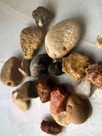 Трехлетний мальчик проглотил камни в Ессентуках | Источник: Минздрав Ставропольского края