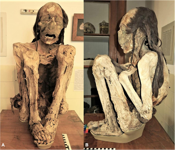 Подстерегли и вонзили нож в спину: древние индейские мумии оказались жертвами преступлений