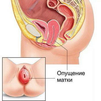 Влагалище Рожавшей И Нерожавшей Женщины Фото