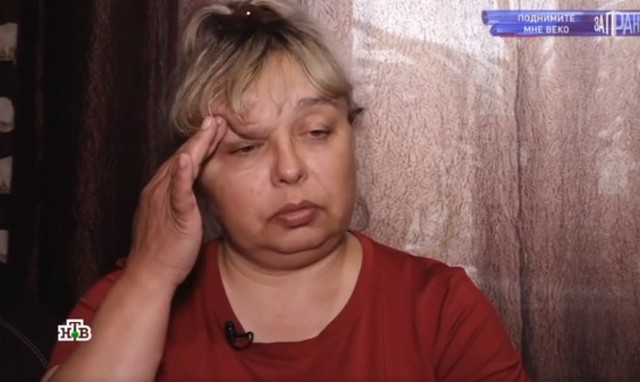 Женщина слепнет из-за огромной опухоли над глазом, которая разрослась на половину головы