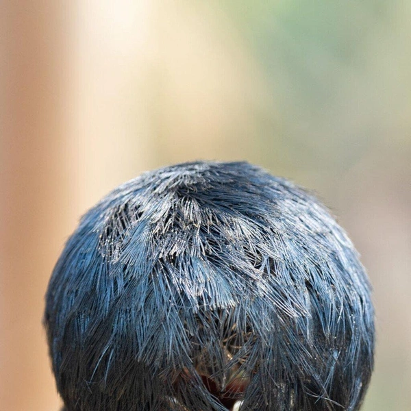 «Попадись мне этот парикмахер…» | Источник: David Fettes / Nikon Comedy Wildlife Awards 2025