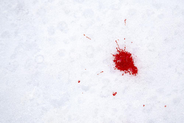 Терзала его на снегу: в Москве овчарка чуть не загрызла младенца