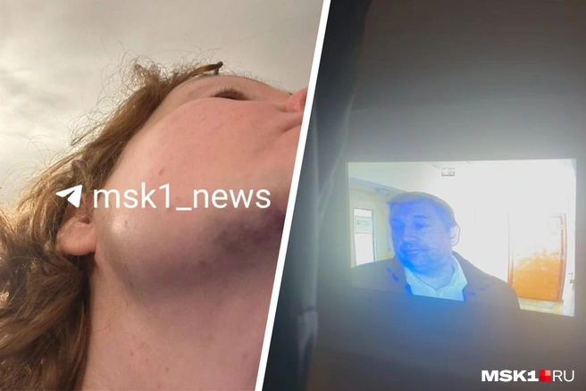 Бывшая жена депутата Мосгордумы Потапова написала на него заявление в полицию из-за избиения | Источник: предоставлено Анной Потаповой MSK1.RU