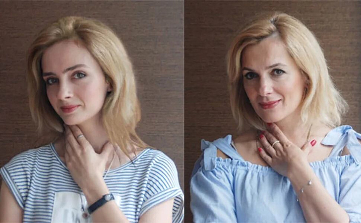 Мария порошина пластика лица до и после фото