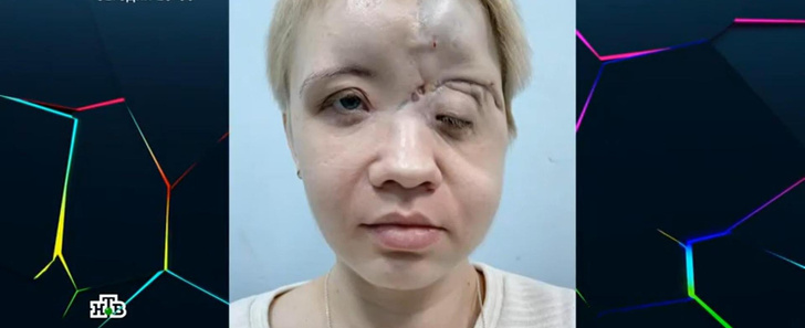 «У дочки ни скул, ни лба, ни глаз»: после удара по Донецку мать с двумя детьми выжила, но потеряла мужа