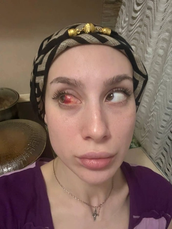А вот так она выглядела, когда все же вернулась домой, на 10 дней позже, чем хотела, и без сына | Источник: Анастасия Степашкина
