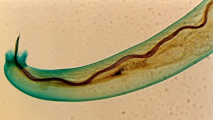 На Гавайях обнаружены опасные для мозга паразиты