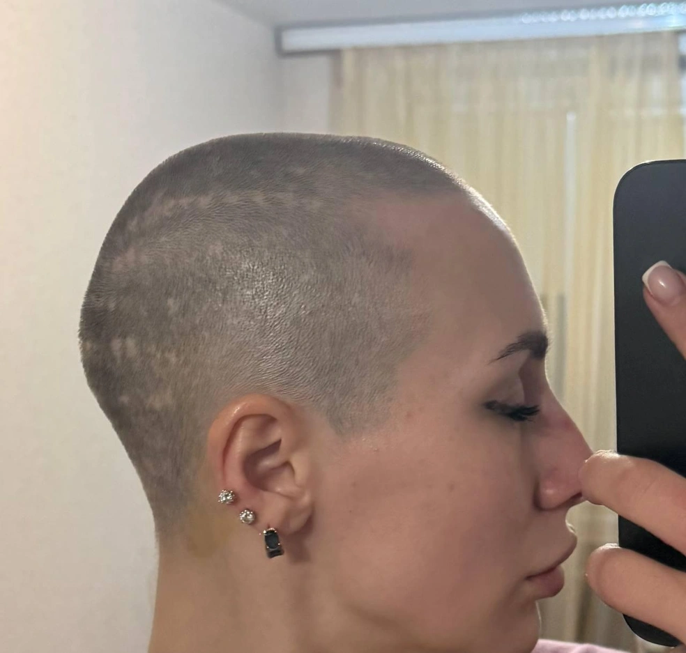 Как рассказала Анастасия, голову она обрила сама, но вовсе не по собственной воле. Это заставил ее сделать Рустам, да еще и снял на видео | Источник: Анастасия Степашкина
