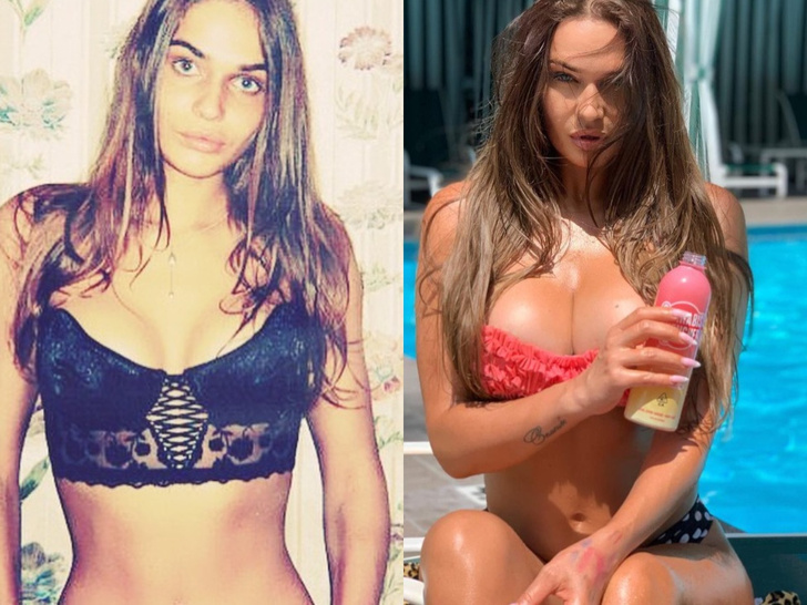 Алена Водонаева до и после пластики фото груди, самые сексуальные фото