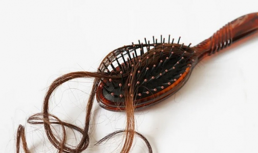 Фото №1 - Выпадение волос и жжение в стопах. Переболевшие COVID-19 жалуются на необъяснимые последствия болезни