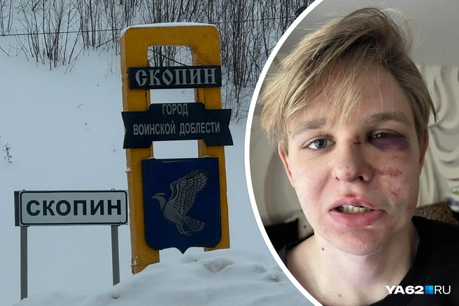 Зима для Данилы из Скопина стала временем лечения | Источник: Сергей Петунин / YA62.RU, Яна Петранкина