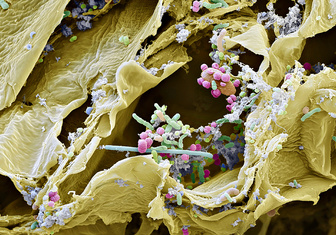 Суть вещей: что можно увидеть, взглянув через микроскоп на квашеную капусту