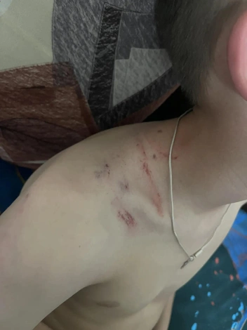 «Я тебя утоплю, понял». Военный избил ребенка из-за взятого без спроса велосипеда в закрытом поселке Забайкалья | Источник: мама