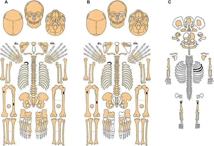 Схема сохранности скелетов, E. Vaníčková, et al., Archaeolo Anthropol Sci (2025) | Источник: E. Vaníčková, et al., Archaeolo Anthropol Sci (2025)