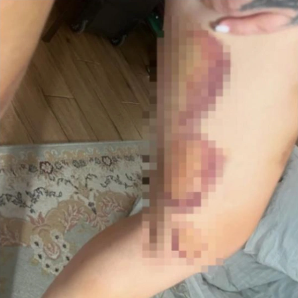 Она написала заявление в полицию 