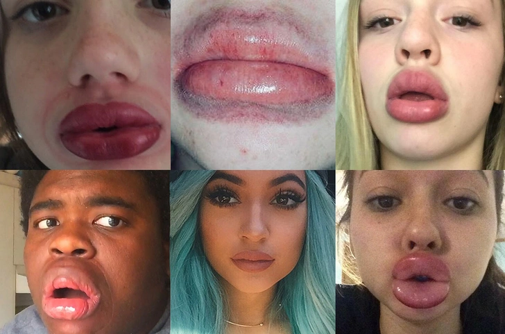 Новый сумасшедший флешмоб #KylieJennerChallenge